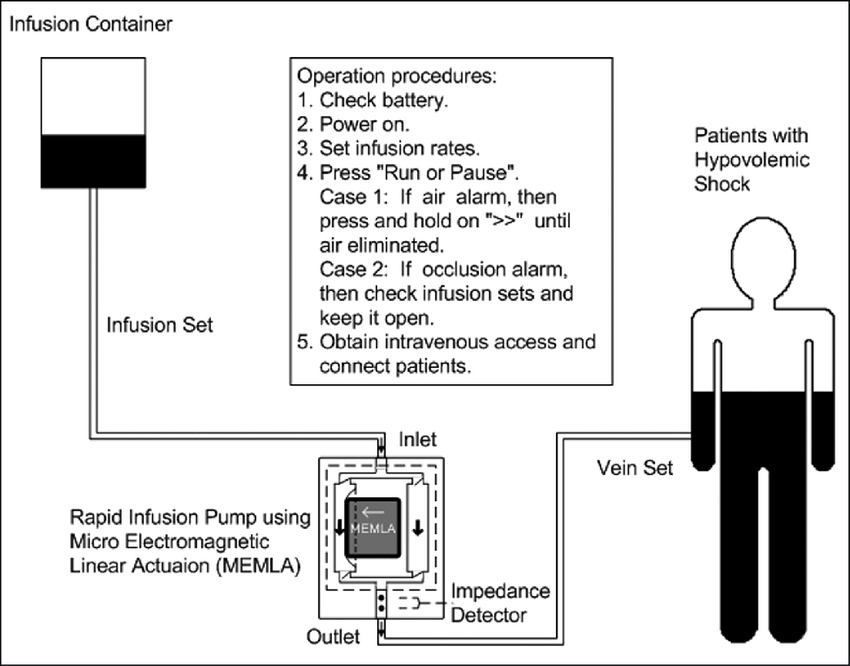 850x666 Principle Sketch Of The Rapid Infusion Device Based On Micro - Principle Sketch
