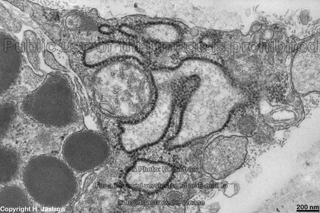 650x432 Rer - Rough Er Sketch