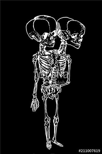 331x500 Graphical Skeleton Of Siamese Twins Isolated On Black,fashion - Siamese Twins Sketch