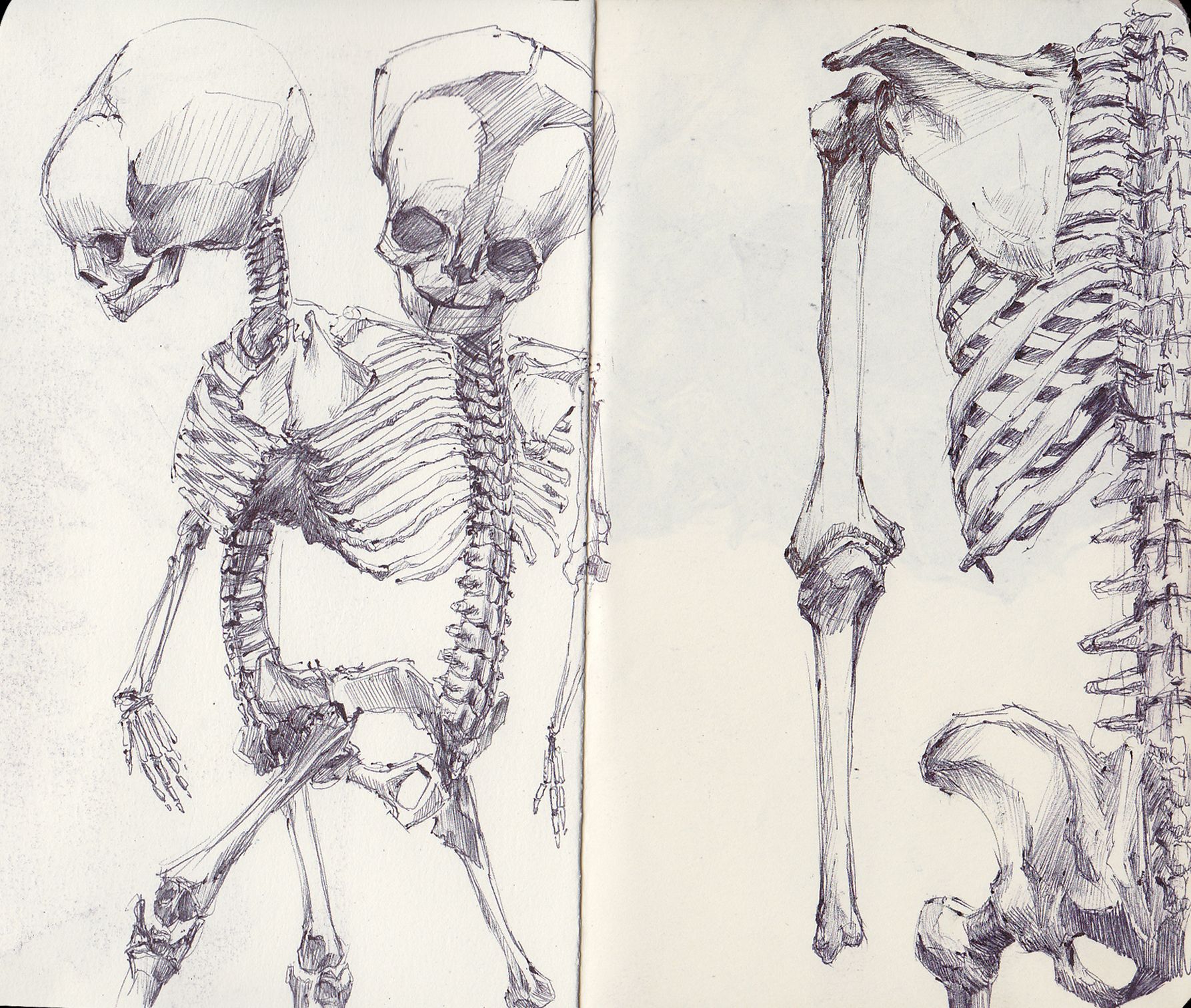 1786x1511 Siamese Twin Fetal Skeleton By Sketchbooknoir - Siamese Twins Sketch