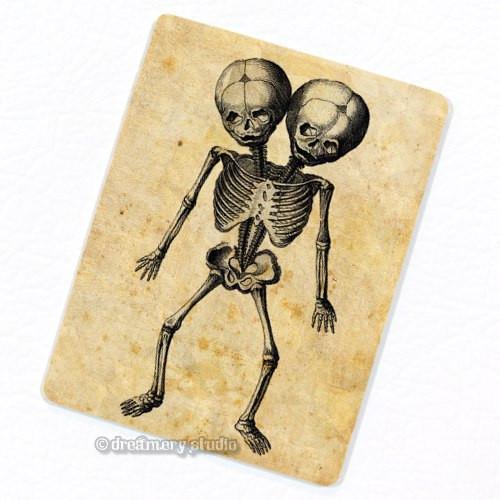 500x500 Siamese Twins Skeleton - Siamese Twins Sketch