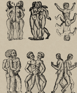 249x300 Conjoined Twins - Siamese Twins Sketch