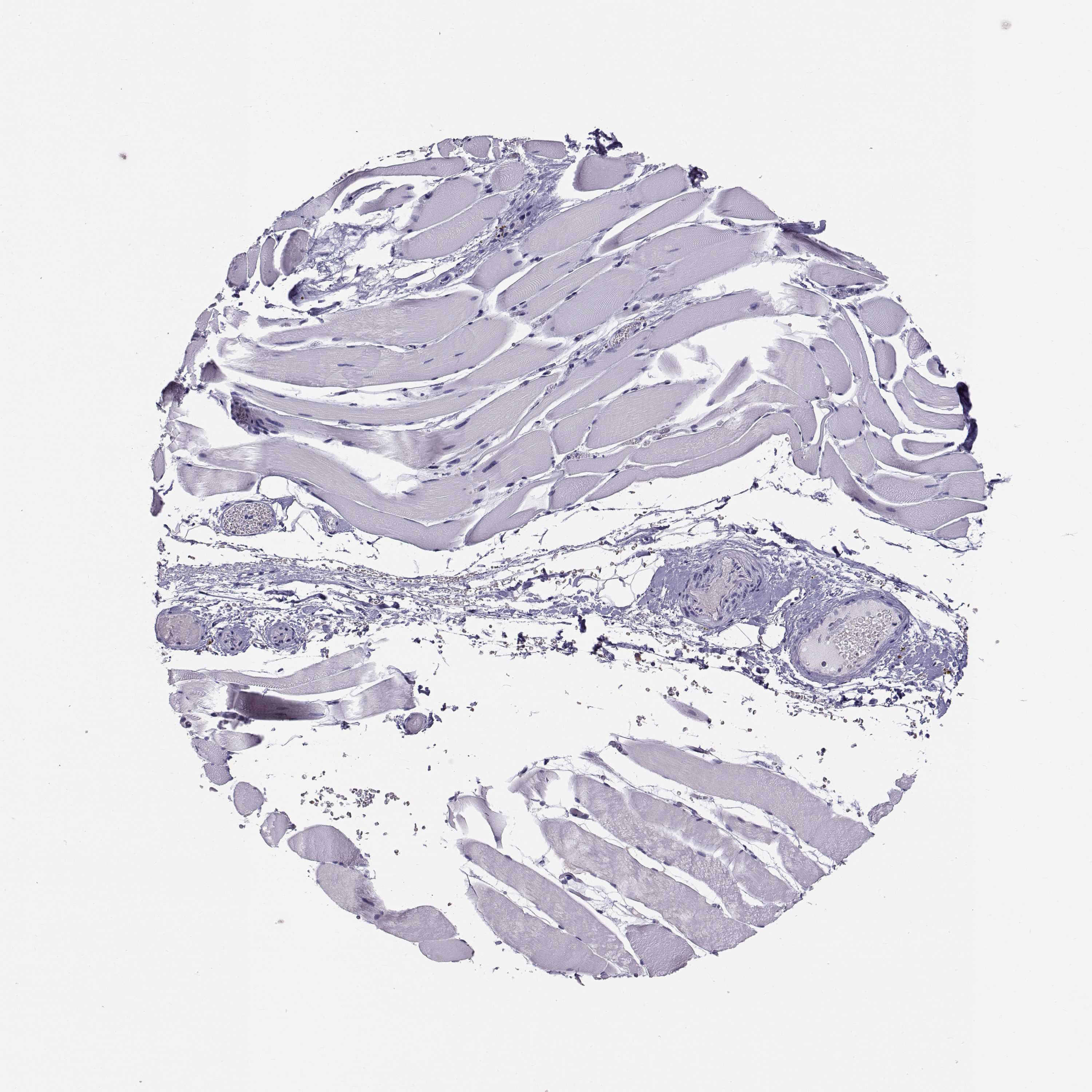 3000x3000 Tissue Expression Of Angpt1 - Skeletal Muscle Sketch