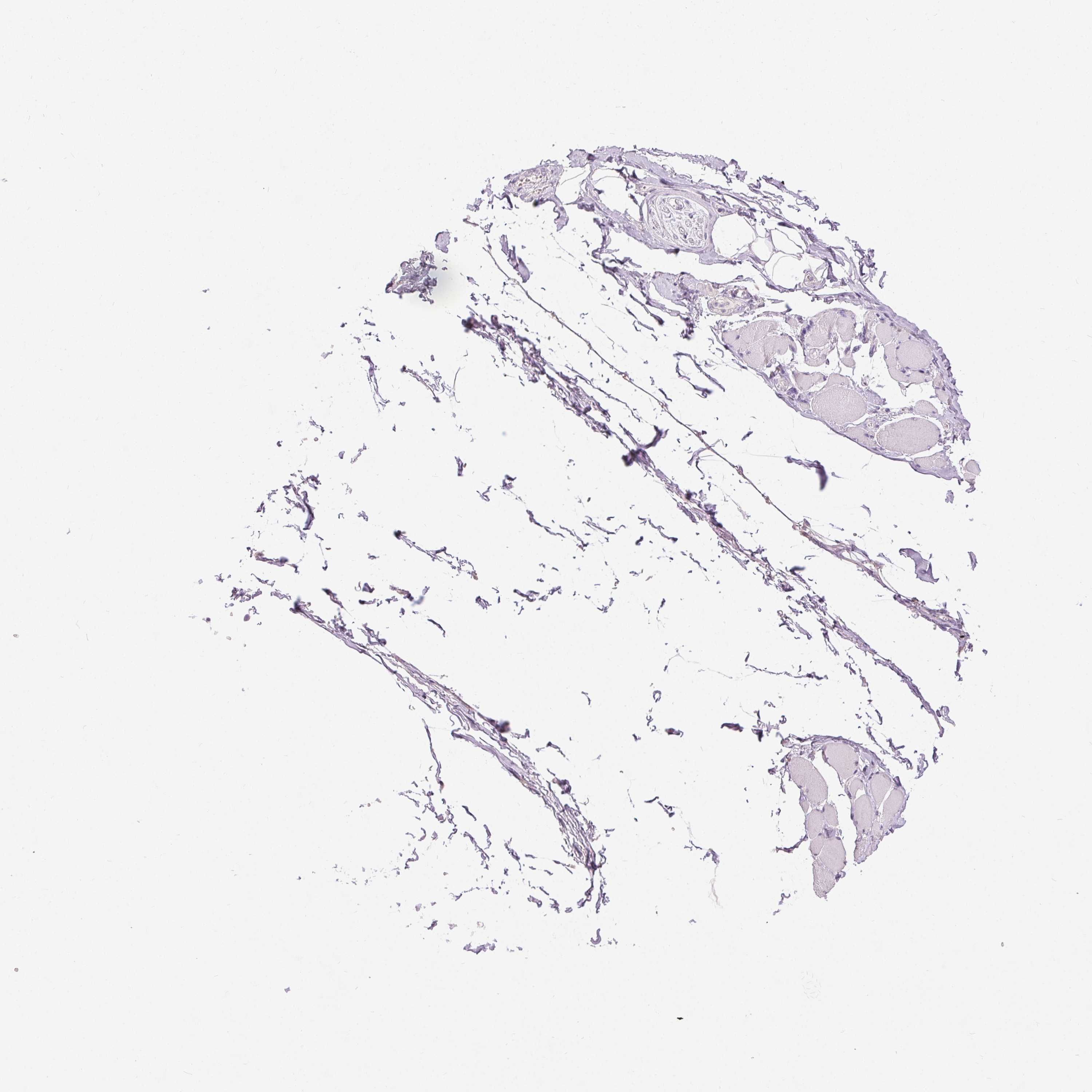 3000x3000 Tissue Expression Of Dsg3 - Skeletal Muscle Sketch