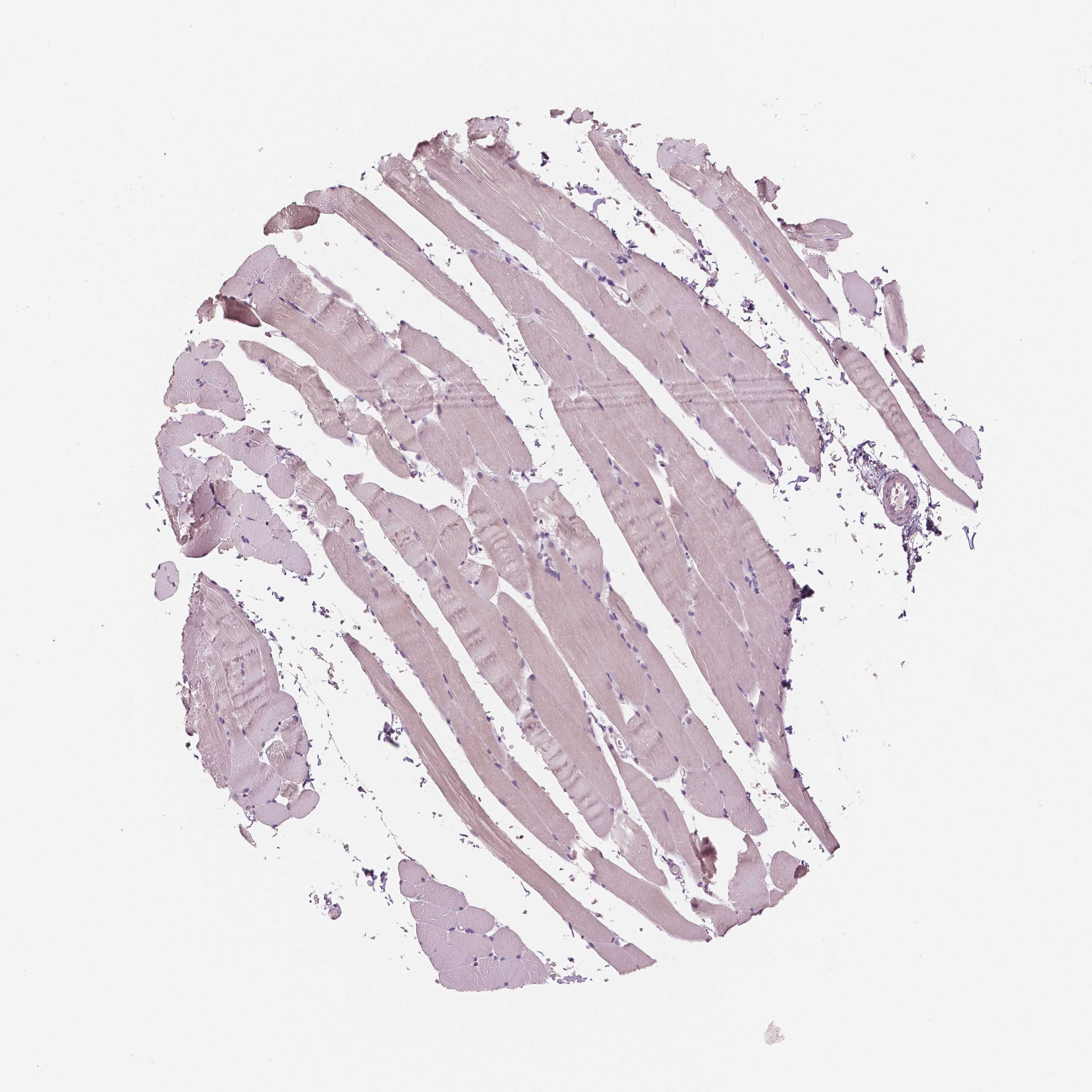 3000x3000 Tissue Expression Of Kit - Skeletal Muscle Sketch