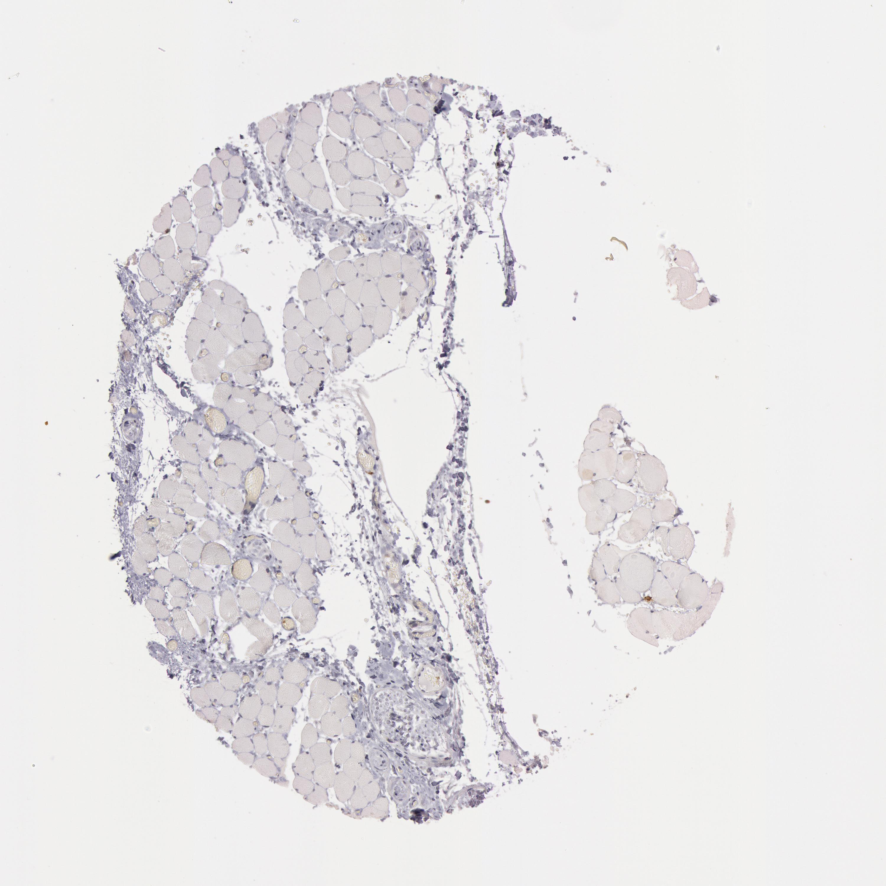 3000x3000 Tissue Expression Of Uty - Skeletal Muscle Sketch