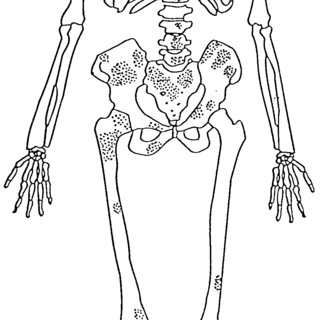 320x320 Sketch Of Skeleton Borovce No. 22992, With Marked Areas Of Large - Skeleton Arm Sketch