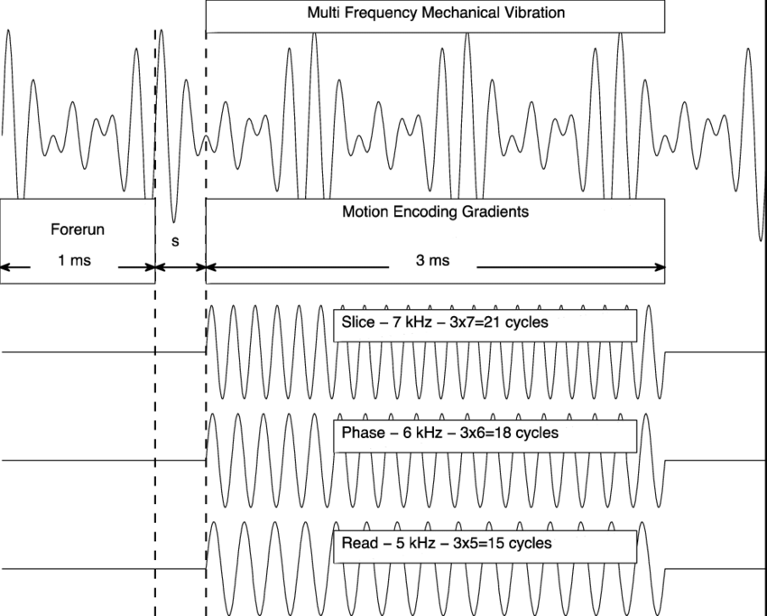 850x682 A Sketch Of The Motion Encoding Scheme In Sdp Mre Relative To The - Sketch Motion