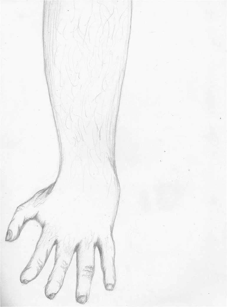 770x1038 Arm Sketch By Heartacid - Sketch Of An Arm