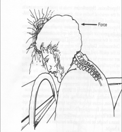 250x270 Spinal Cord Injuries (Exam 4) - Spinal Cord Sketch