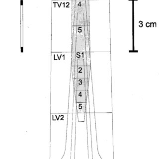 320x320 Anatomical Sketch Of Lumbar Spine And Lumbosacral Spinal Cord - Spinal Cord Sketch