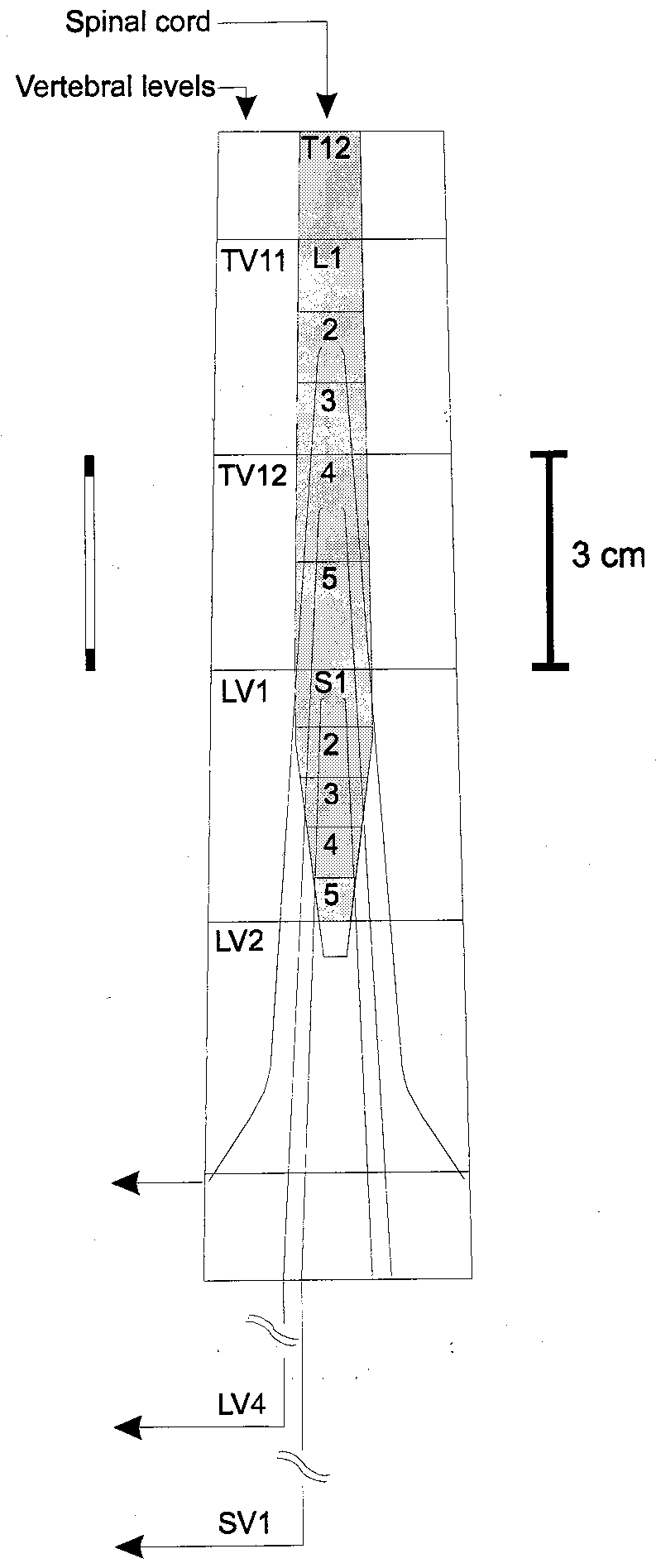793x1895 Anatomical Sketch Of Lumbar Spine And Lumbosacral Spinal Cord - Spinal Cord Sketch