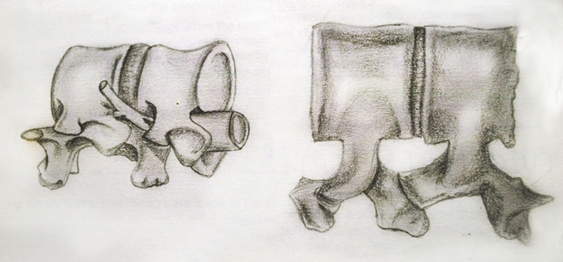 789x367 Quick And Detailed Sketch Of Bone For My Bridge Spine Laura - Spine Sketch