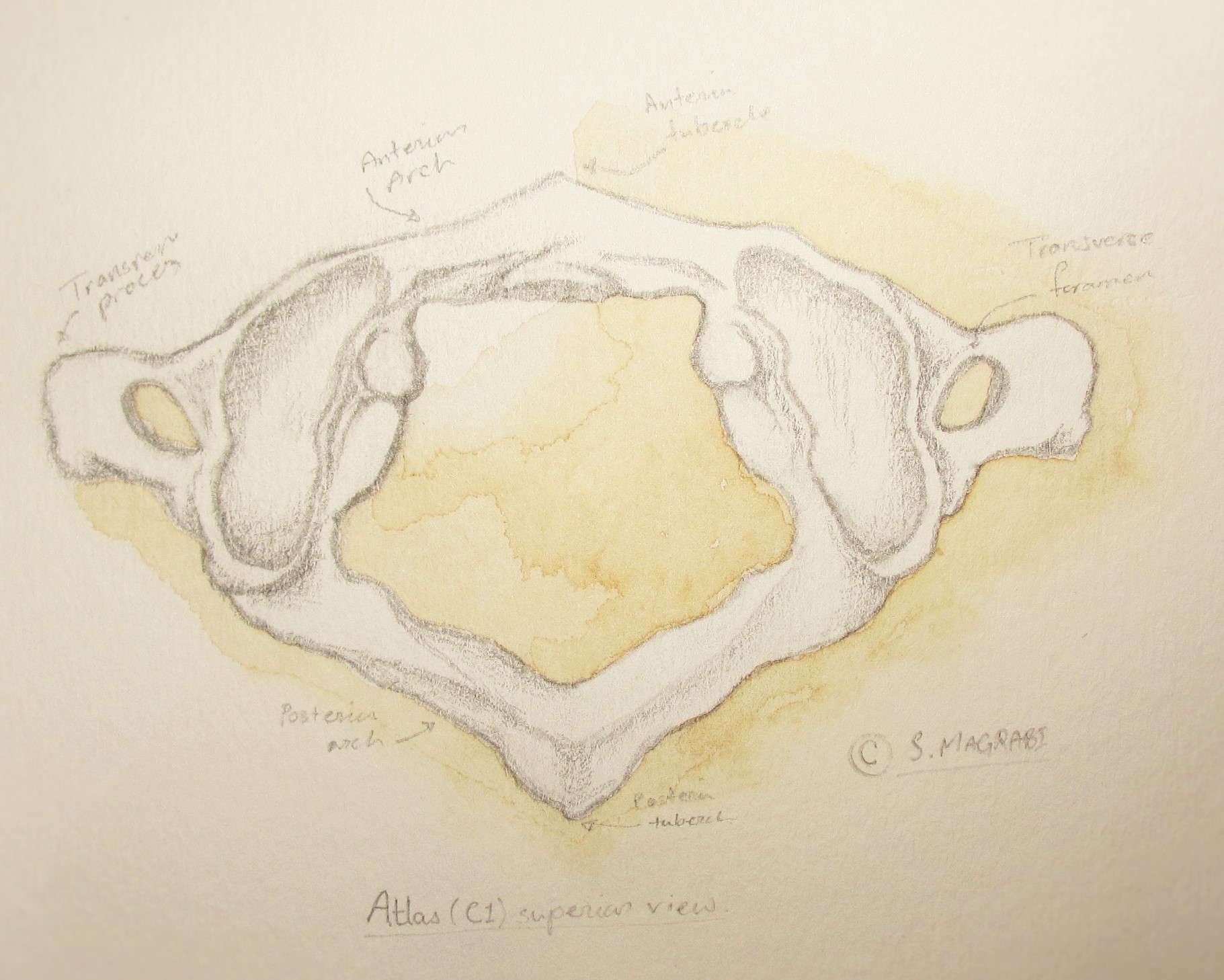 1821x1458 Spine Ortho Illustrations - Spine Sketch