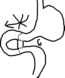250x298 Stomach Operation Sketch. Download Scientific Diagram - Stomach Sketch