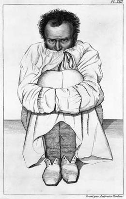 260x411 Image - Straight Jacket Sketch