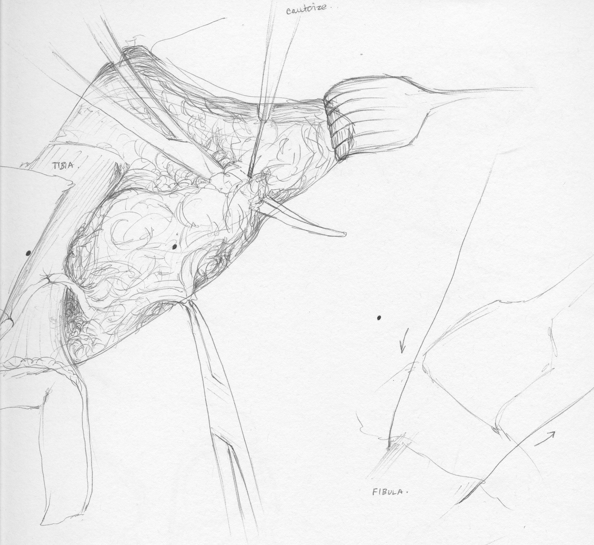 2268x2083 Surgical Endoplasmiccurriculum - Surgeon Sketch