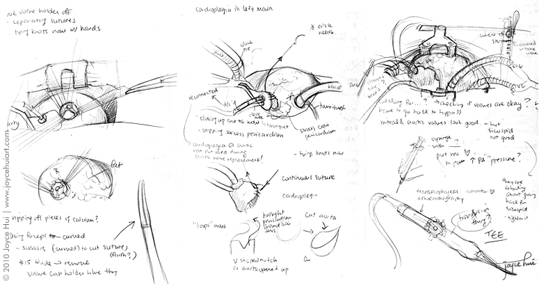 785x408 Joyce Hui Portfolio - Surgery Sketch