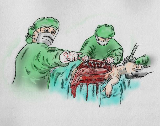 610x480 Surgery And Sketches Drawn From The Or - Surgery Sketch