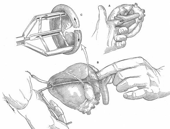578x440 Canine Heart Surgery Drawing Sketch Image Illustration - Surgery Sketch