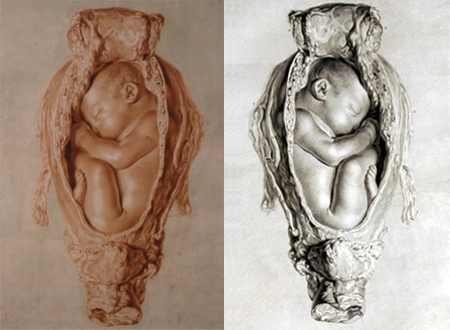 450x330 Jan Van Rymsdyk Drawer Of Wombs The Sterile Eye - Uterus Sketch