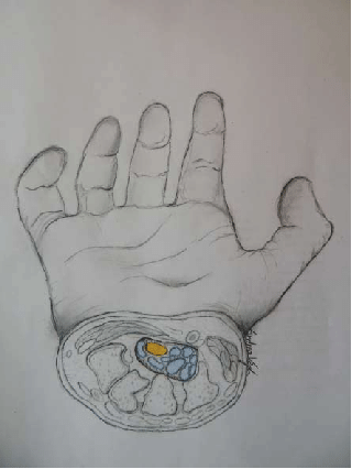 320x426 Sketch Of The Cross Section Of The Carpal Tunnel On A Hand. Median - Wrist Sketch