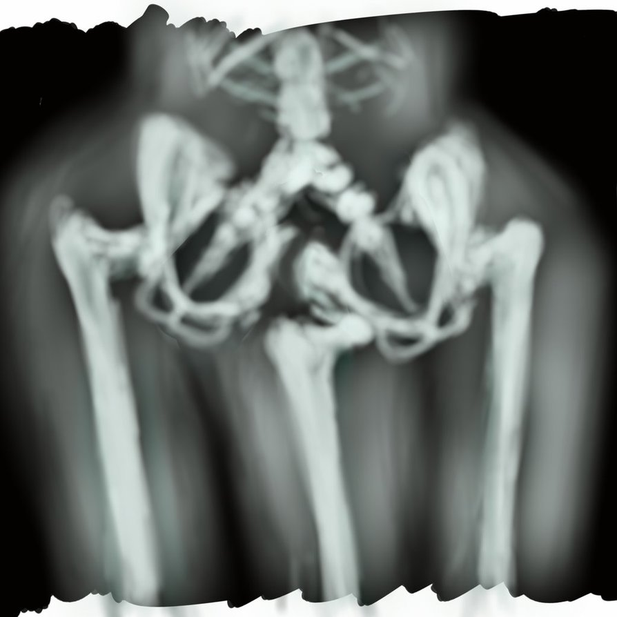 894x894 Dipygus X Ray Sketch By Hesperornis - X Ray Sketch